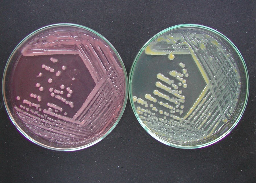 Brasil tem o primeiro laboratório público de pesquisa acreditado para análise de inoculantes